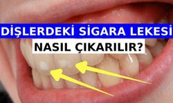 Dişlerdeki Sigara Lekesi Nasıl Çıkarılır?